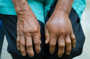 Moringa Side Effects
